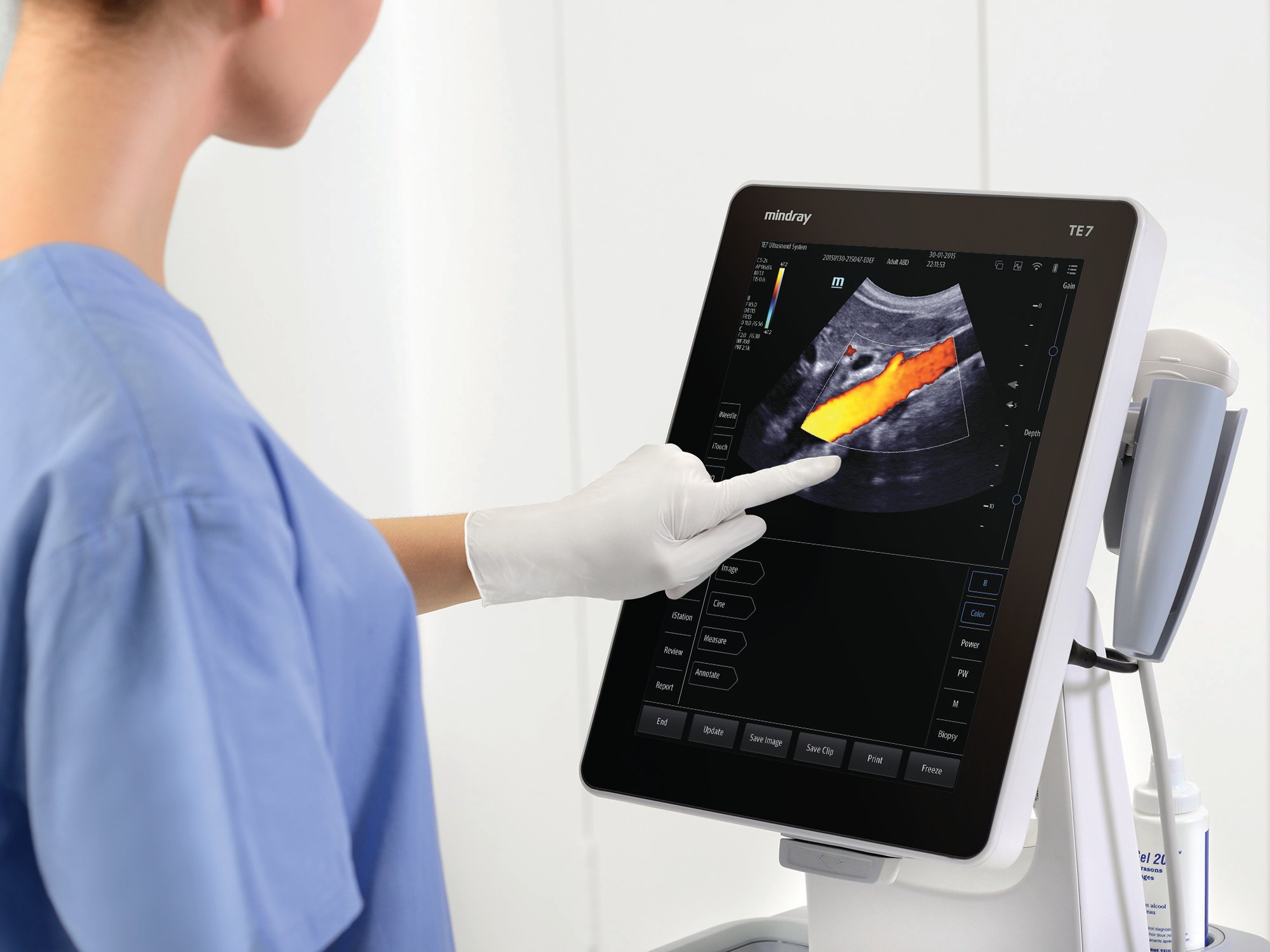 Mindray Introduces TE7 Touch Enabled Ultrasound System for Point